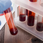 Blood in test tubes