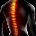 Spine problems