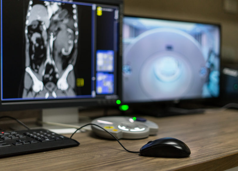 Delayed Diagnosis A North East Nhs Trust Breast Cancer Crisis - sbzfqz0