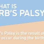what is erbs palsy