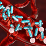 sepsis