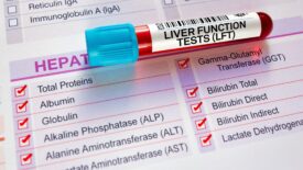 Haemochromatosis complications and compensation